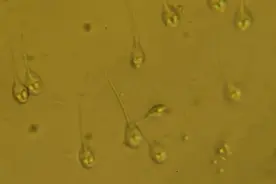 万物生长靠氧气？这种寄生虫已经跳出“三界外”图片
