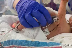啥情况？孟加拉妇女生下儿子一个月后又生了一对双胞胎图片