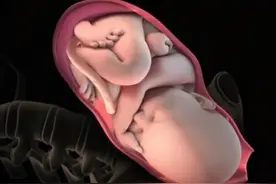 8张图带你了解顺产全过程，隔着屏幕都觉得疼，宝宝也很努力图片