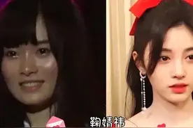 明星整容前和整容后的变化，判若两人图片