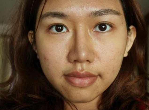 我国有一老成分,能补气还能去黄,提亮肤色,不输烟酰胺