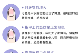 身体好不好，看手就知道？一文教你从手上看出身体状况，附对比图图片