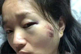 嫁给一个傻子男人是一件多么痛苦的事情图片