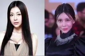 被整容坑惨的十大女星，有的变脸有的毁容，为何还是会上瘾？图片
