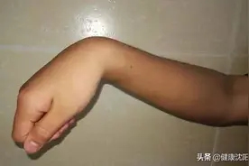 健康科普堂 | 醒后右手不能抬起的青年男性图片