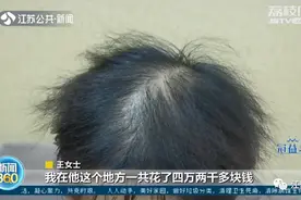 “为了长点头发，我真的很不容易！”女子花4.2万植发，效果却让她崩溃了图片