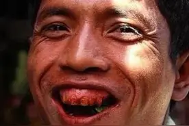 我吃了十几年槟郎的自述危害图片