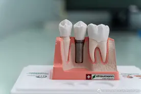 在厦门种植牙看这一篇就够了图片