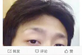 张一山发文向粉丝道歉，只是眼睛湿润模糊了，以后我们将就着过！图片