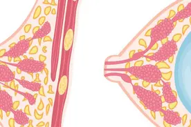 乳房摸起来硬硬的就是乳腺癌吗？别担心，可能是这3种问题图片