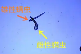三根睫毛寄生17条螨虫，撸猫的你要当心图片