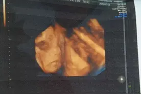 分享一下我的四维经历，真是个贴心的好宝宝呢图片