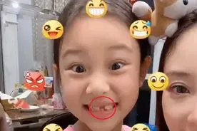 甜馨掉牙后做搞怪表情，和妈妈李小璐同框机灵又漂亮图片