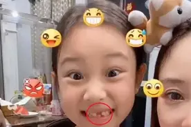 甜馨掉牙后做搞怪表情，和妈妈李小璐同框机灵又漂亮图片
