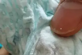 拉拉裤划伤婴儿，究竟有无设计问题需给个说法图片