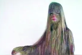 一出生，她全身长满毛发，从“毛猴子”到漂亮女孩，她经历了什么图片