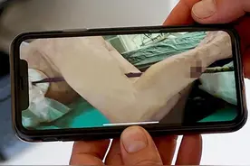 80厘米长铁棍扎穿车底板，俄罗斯司机的腿像串肉一样被串了起来图片