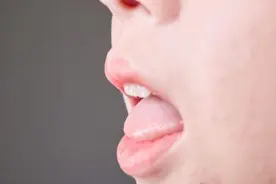 吃饭经常咬到舌头？别总以为是馋肉，其实可能是大病要来的信号图片
