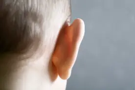 新生儿外耳畸形能否自愈？图片