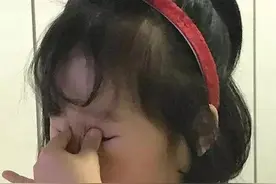 千万别乱用！福州女子用网红眼药水患上干眼症！超详细眼药水挑选指南来了图片