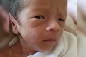 刚生下来的丑娃不要扔！没准儿过几天他就长开了，网友：堪比换头图片