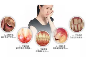 牙松了还有救吗？什么情况下，牙齿需要拔掉？#雅悦齿科#图片