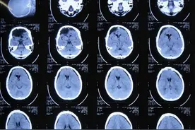 10岁男孩，呕吐入院，2小时后去世！切记孩子身上有3处，打不得图片