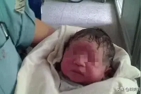 带着羊膜出生的宝宝，自带幸运降临，你见过吗?图片