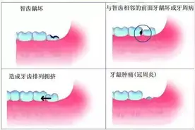 牙齿不齐也是一种病你知道吗？图片