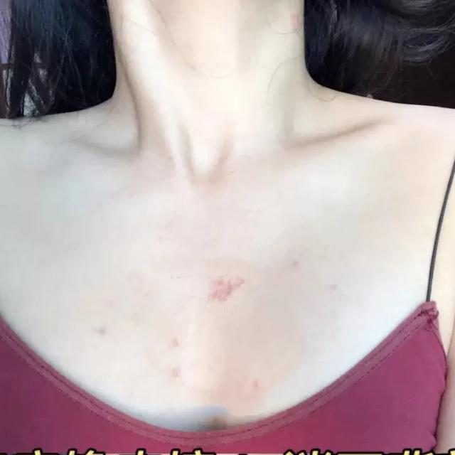 野脚鸡皮肤穿裙子 野脚鸡皮肤穿裙子