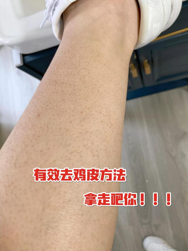 洗澡怎样去鸡皮疙瘩