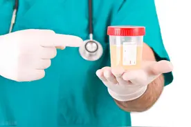 尿蛋白3+很严重？不要慌，明确这4点才重要图片