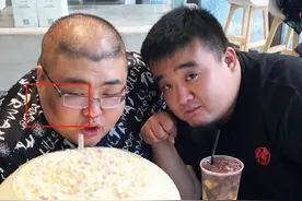 吃播们的疯狂史：有人嘴角牙齿烂掉，有人英年早逝，该怪谁呢？图片