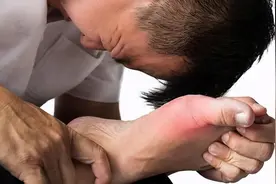 出现这3点迹象，恭喜你，是痛风好转的“信号”图片