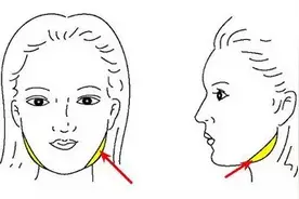 浅析面部不对称：下颌角变化怎样形成大小脸图片