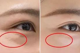 生活小妙招：轻松去除多年鱼尾纹！你值得收藏图片