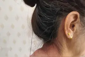 （原创）我们怎样才能早期发现自己是否患了脊柱病？（三）图片
