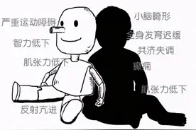 快乐木偶综合征——为何宝宝不会说话只会笑？图片