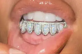 名媛卡戴珊晒骑马照，生完4个娃也不见老！在牙上镶满宝石好辣眼图片