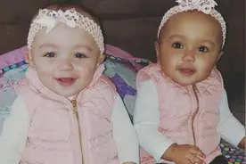 百万分之一的概率，英国双胞胎一个是黑人，一个是白人图片