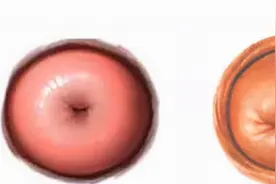 宝妈产检陷入纠结：婚前有流产史，可我不想让老公和医生知道图片