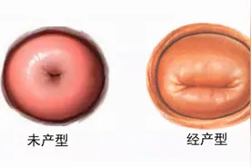 宝妈产检陷入纠结：婚前有流产史，可我不想让老公和医生知道图片