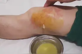 警示！骨科医生说：6大膝关节疼痛切勿轻视，薇娅也中招图片