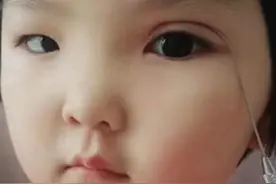 为让6岁女儿变美，宝妈亲手为娃“割双眼皮”，网友：不心疼吗？图片