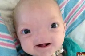 “折翼天使”出生，家人崩溃，下一秒宝宝的举动让妈妈热泪盈眶图片