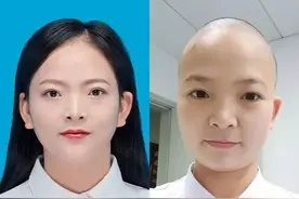90后女护士将齐腰长发剃成光头：方便穿防护服图片