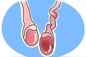 男孩“蛋疼”3天被切除，妈妈多做一件事就能避免的！图片