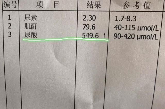 夏天痛风“高发期”，这2物大胆吃，尿酸一天天降下来