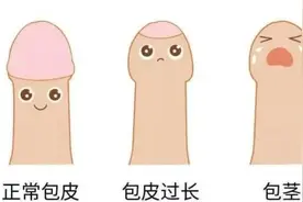 Bao皮过长和Bao茎，有什么区别图片