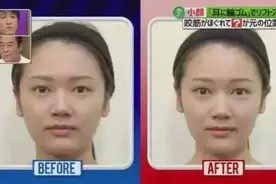 转发收藏|让脸变大的4个生活习惯，脸部按摩就能变小！图片